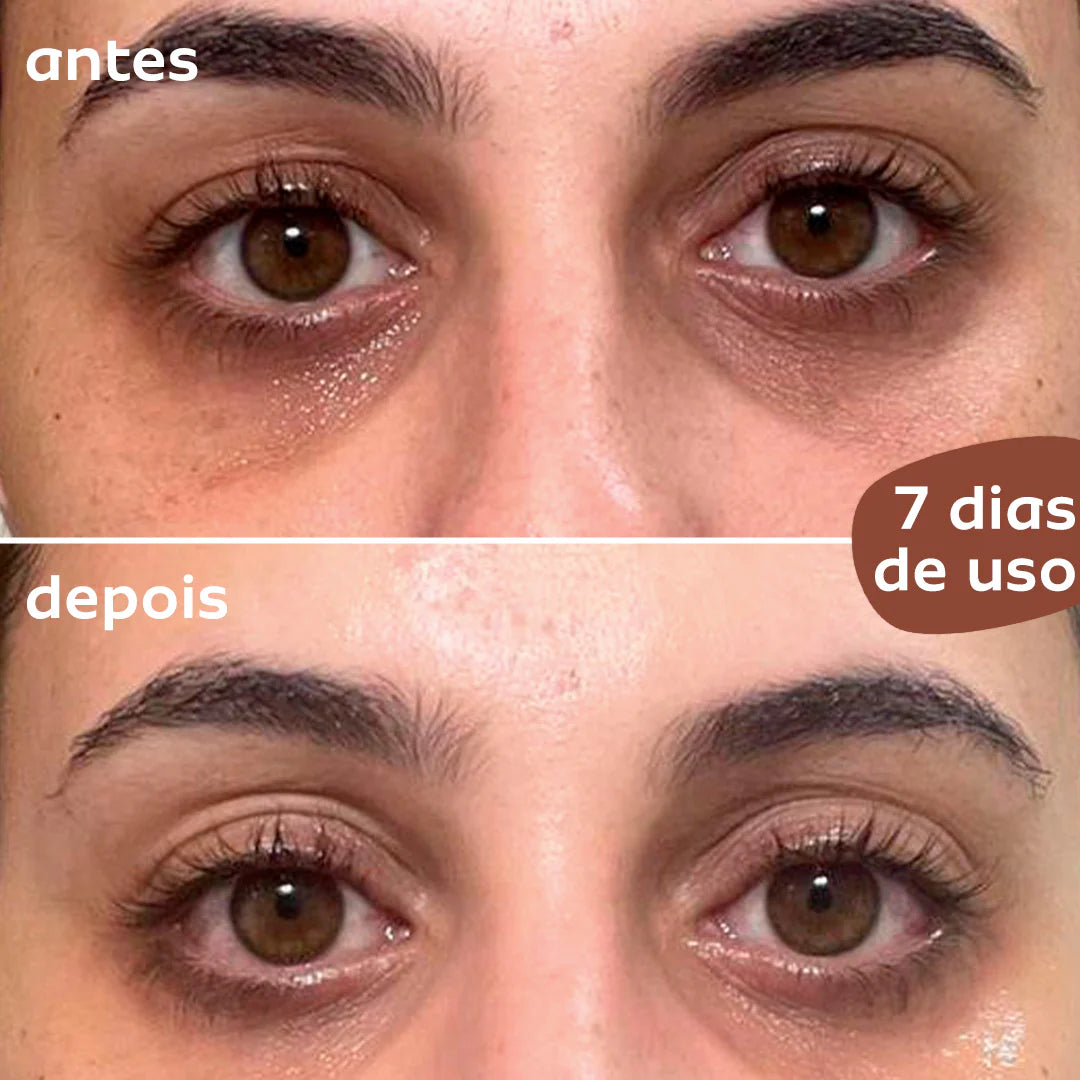 5-in-1 Lutein Ultra-Revitalizing Roller