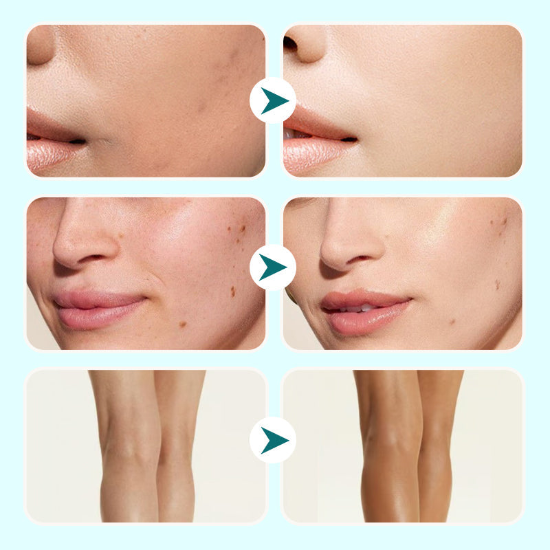 💕Ograniczony czas 50% zniżki💕Nawilżający korektor wodoodporny w kremie dla kobiet