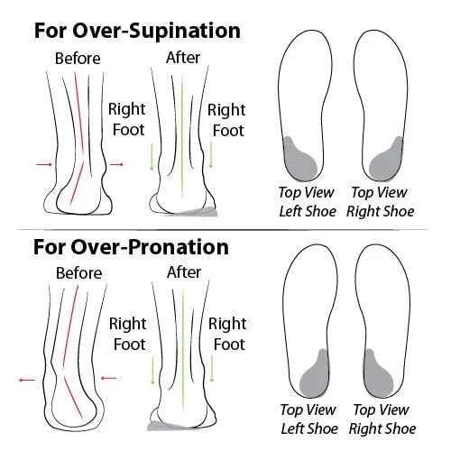 🔥Summer Best Seller🔥CNSN Women's Summer Fisherman Sandals