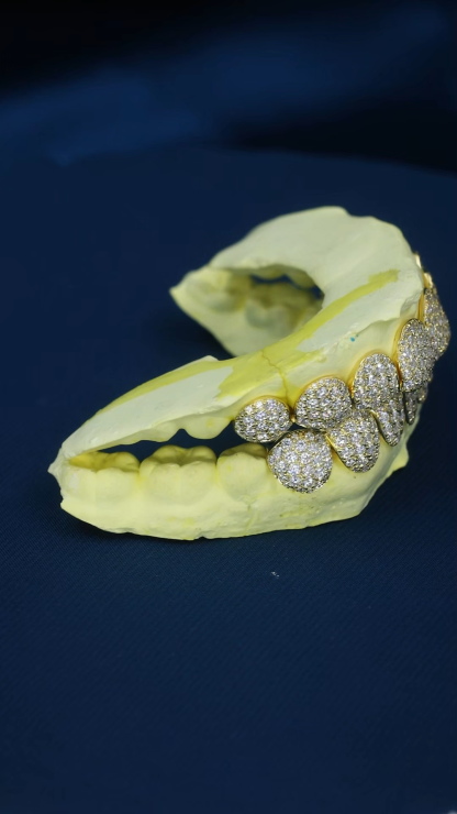Custom S925 Silver Yellow Gold Plated Top & Bottom 10 VVS Moissanite Diamond Perm cut Honeycomb Setting Teeth Grillz