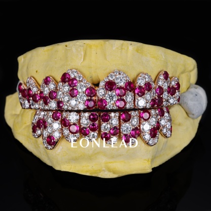 Custom Rose Gold Full Set Top & Bottom Grillz Mixed Round Ruby & White Moissanite Jumbo Pave Teeth Grills Hip Hop Rapper Custom Grillz For Men Women