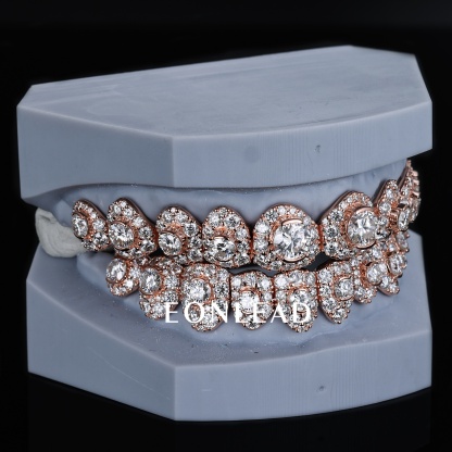 Custom Rose Gold Iced Out Grillz Top & Bottom Honeymoon Set Custom Round Cut D VVS Moissanite Lab Diamond Teeth Grillz for Hip Hop Rapper Jewelry