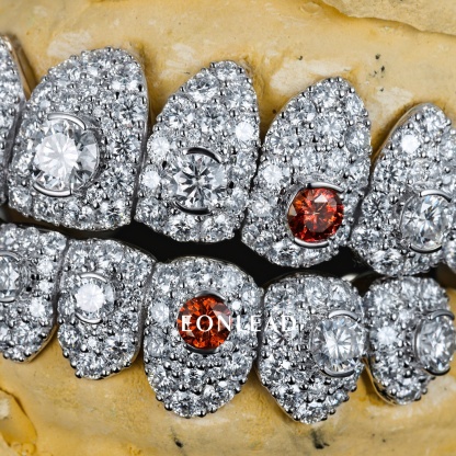 Custom Full Pave D VVS Moissanite Grillz Setting Big Round Diamond & Red Ruby Stones 925 Silver Iced Out Top Bottom Dental Teeth Grills Hip Hop Jewelry