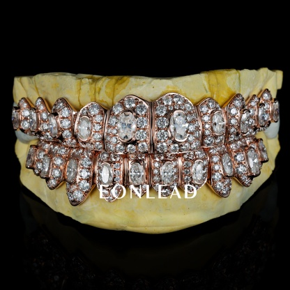 Custom Iced Out Oval Diamond Rose Gold Honeymoon Setting Grillz Hip Hop Teeth Grillz 10 Top And Bottom Set For Men Women