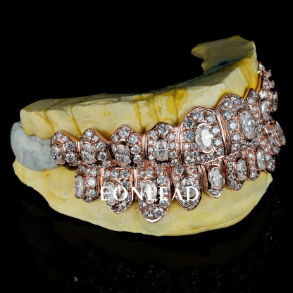 Custom Iced Out Oval Diamond Rose Gold Honeymoon Setting Grillz Hip Hop Teeth Grillz 10 Top And Bottom Set For Men Women