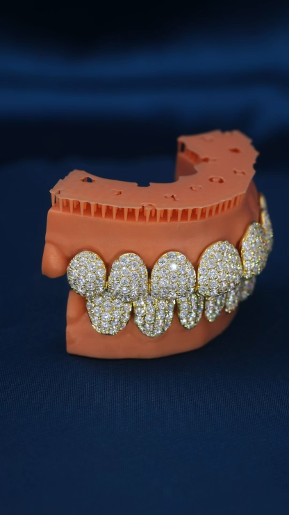 Custom S925 Silver Yellow Gold Plated Top & Bottom 10 VVS Moissanite Diamond Perm cut Teeth Grillz for Men Women