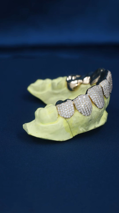 Custom S925 Silver Yellow Gold Plated Bottom 10 VVS Moissanite Diamond Perm cut Teeth Grillz for Men Women