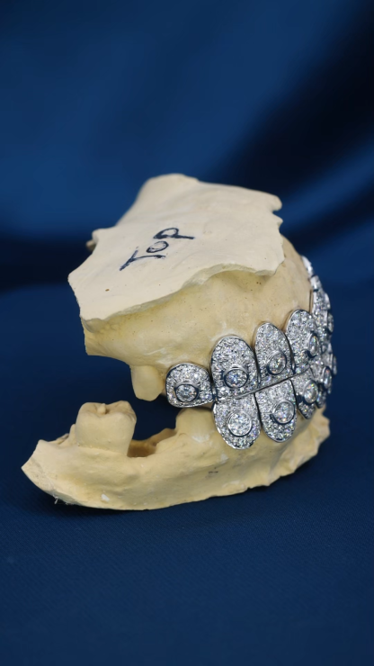 Custom Women Men S925 Silver White Gold Plated Top & Bottom 8 Flawless Big Moissanite Diamond Perm cut Teeth Grillz