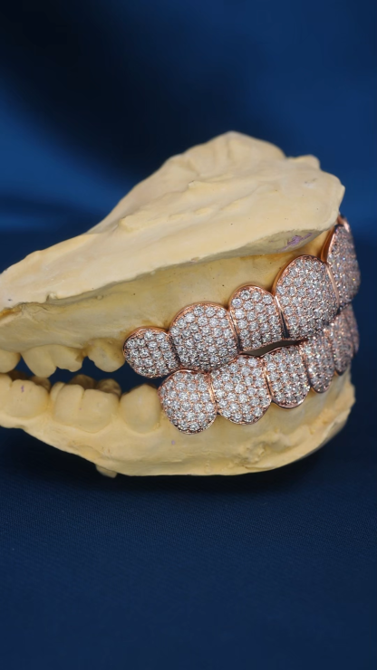 Custom Top & Bottom 8  S925 Silver Rose Gold Plated VVS Moissanite Diamond Regular Cut Teeth Grillz