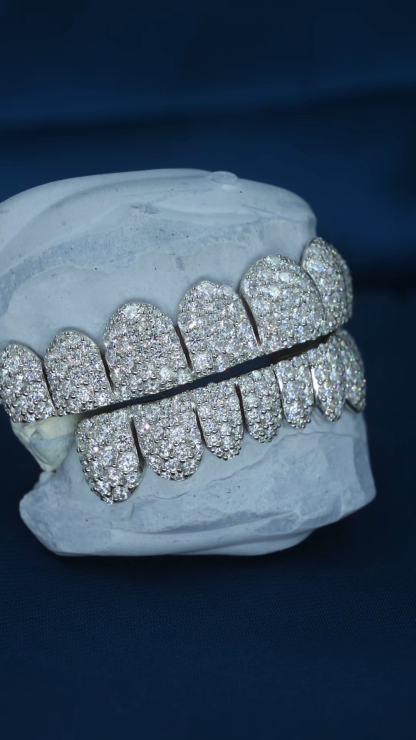 Custom Men Women TOP BOTTOM 2 4 6 8 10 Moissanite Lab Diamond Grillz Honeycomb S925 Silver 10K 18K 14K Solid Gold Teeth Grillz