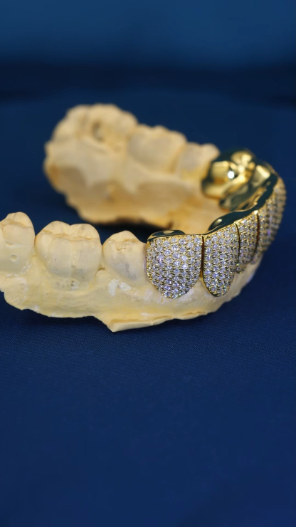 Custom S925 Silver Yellow Gold Plated Bottom 8 Flawless Moissanite Diamond Perm cut Honeycomb Setting Teeth Grillz
