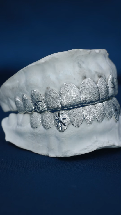 Custom S925 Solid Plain Silver White Gold Plated Top & Bottom 8 Deep cut Teeth Grillz