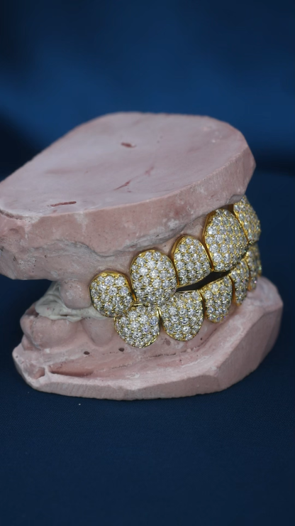 Custom Top & Bottom 10  S925 Silver Gold Plated VVS Moissanite Diamond Perm Cut Honeycomb Setting Teeth Grillz