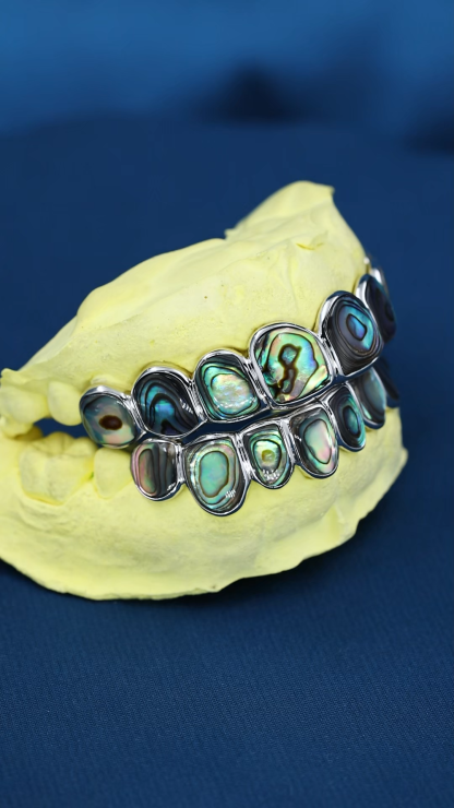 Custom Top & Bottom 8  S925 Silver White Gold Plated Abalone Teeth Grillz