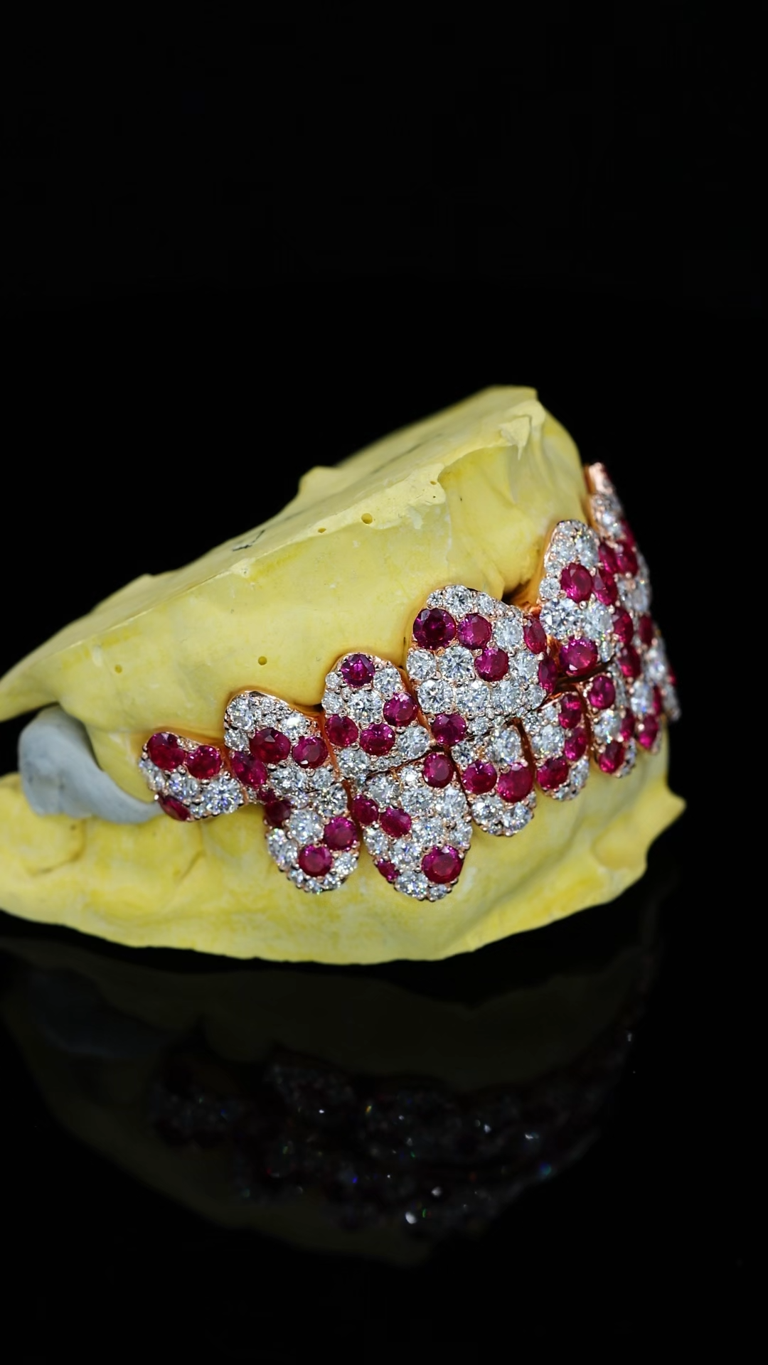 Custom Rose Gold Full Set Top & Bottom Grillz Mixed Round Ruby & White Moissanite Jumbo Pave Teeth Grills Hip Hop Rapper Custom Grillz For Men Women