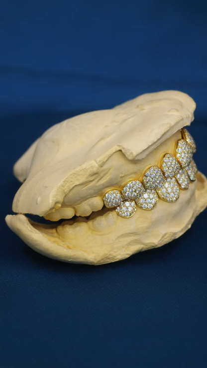 Custom Top & Bottom 10  S925 Silver Yellow Gold Plated VVS Moissanite Diamond Natural Cut Honeycomb Setting Teeth Grillz