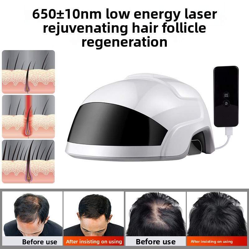 2025 Lescolton Men Hair Growth Cap LLLT Helmet Laser Hair Regrowth Hair Loss Laser Hair Fast Growth Anti Hair Loss Device
