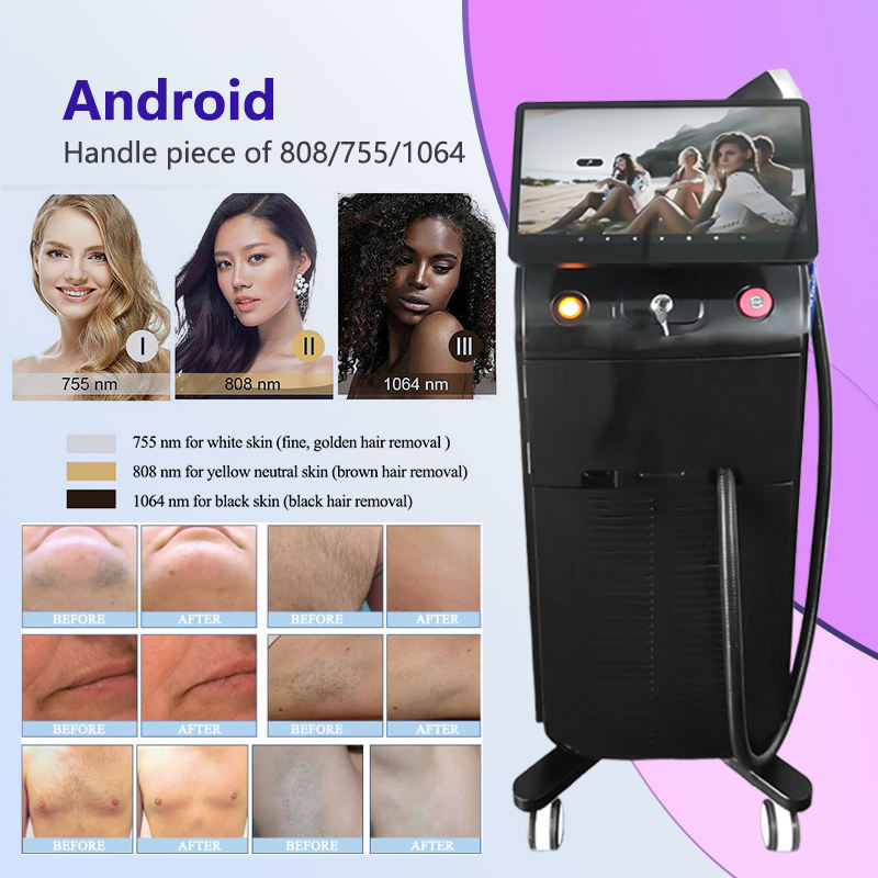 Hottest Portable Body Facial Electrolysis Hair Removal Machine for Home Hair Remover Machine for Women Men
