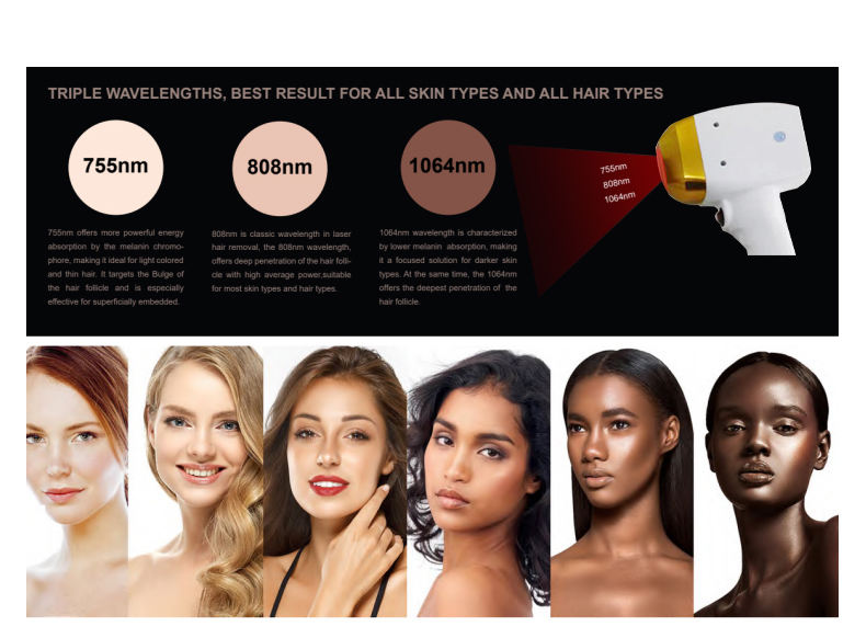 808 diode laser hair removal machine pico tattoo removal professional diode laser tattoo removal best price newest device