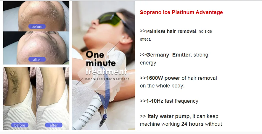4 Wavelength 755/808/940/1064nm Diode Laser Hair Removal/500w-1600w Diode Laser Beauty Machine/Skin Rejuvenation 1200w 1000w