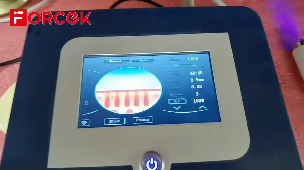 Portable Fractional RF Micro-needle For Face Treatment