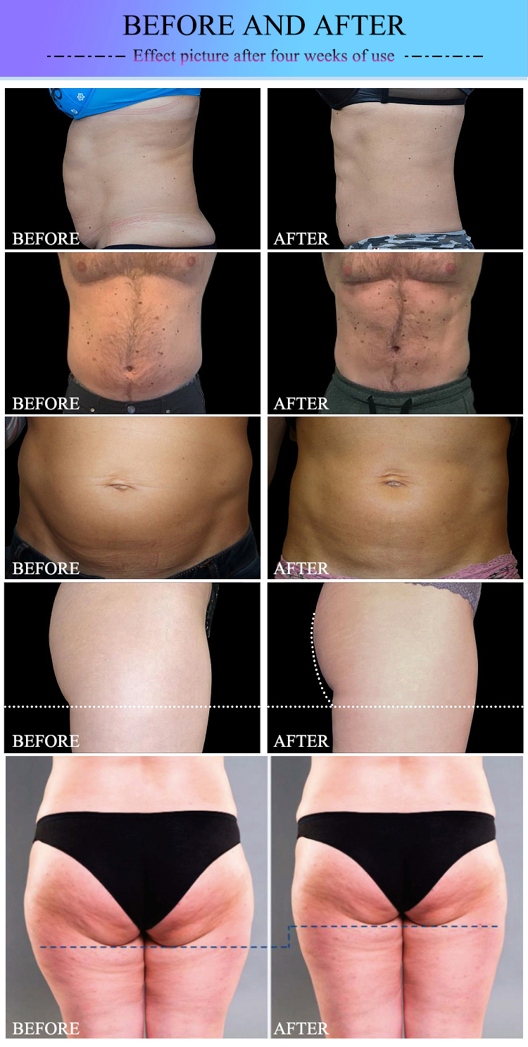 EMS Sculpting Machine 2 handles Ems body vacuum cavitation 2 Handle EMS Sculpt Fat Burning abs Electromagnetic Muscle
