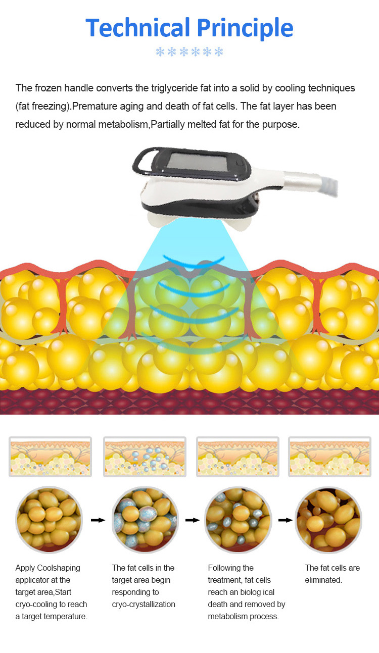 Cryolipolysis Machine Cryo Fatty Freezing Cold Vacuum Fat Freezing Machine Double Chin Removal 360 Cryolipolysis Machine