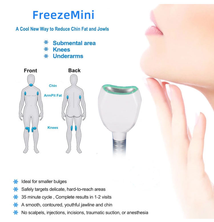 Cryo Slimming MachineDouble Chin Cryo Slim 360 Cryolipolysis Slimming Cyrolipolysis Cool Fat Freezing Sculpting Machine