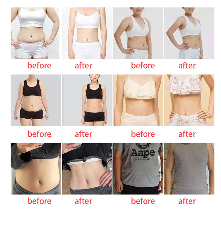2023 Portable 360 Degree Cryotherapy Fat Freezing Machine 360 Cryolipolisis 3 Cryo Handles Fat Freezing Slimming Machine