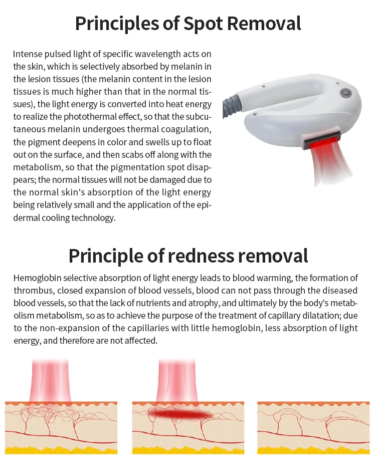 Functional Skin Care Skin Rejuvenation Machine Redness Removal DPL 550-650nm Spot Removal Fast Hair Removal Machine