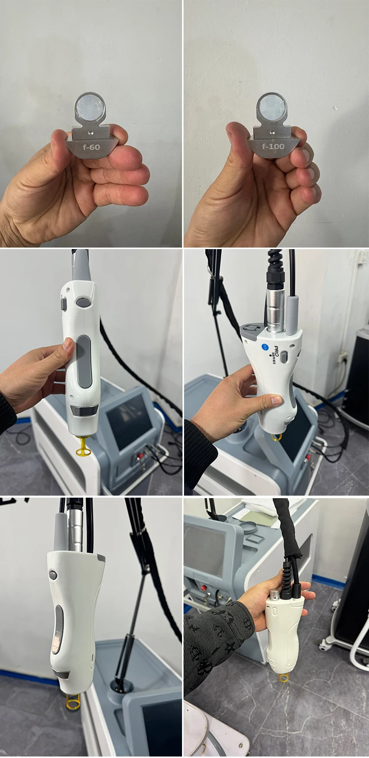 Cheapest Alexandrite Hair Removal Machine Long Pulse Laser for Hair Removal Hemangioma Blood Veins Vascular Skin Rejuvenation