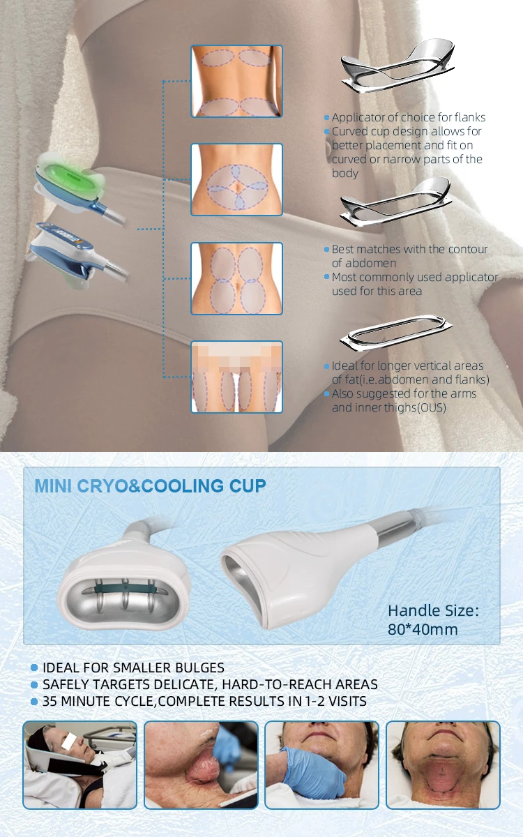 High Quality Cryo Therapy 360 Degree Cryolipolyse Fat Freeze Slimming Machine