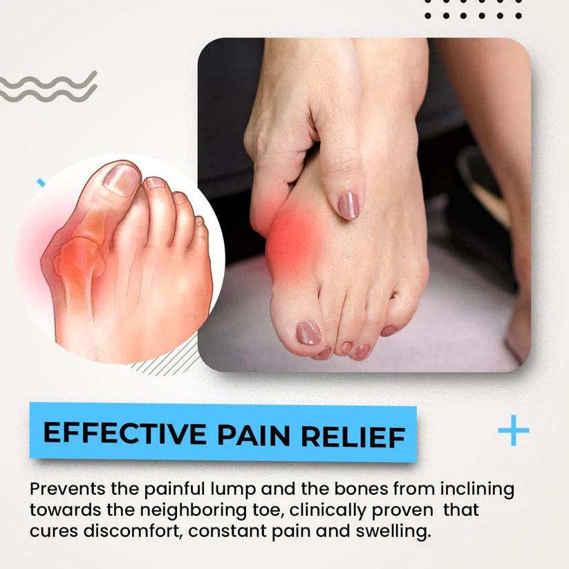 3D Bunion Splint Corrector Toe Trainer