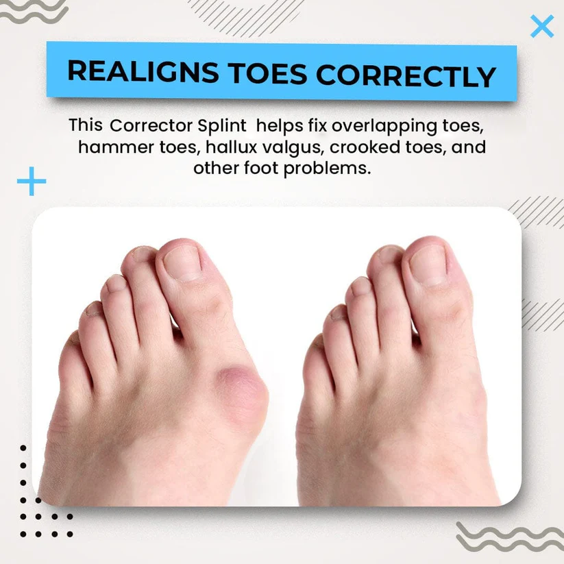 3D Bunion Splint Corrector Toe Trainer