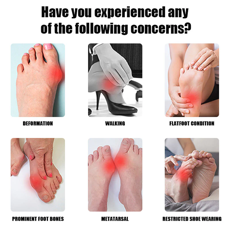 3D Bunion Splint Corrector Toe Trainer