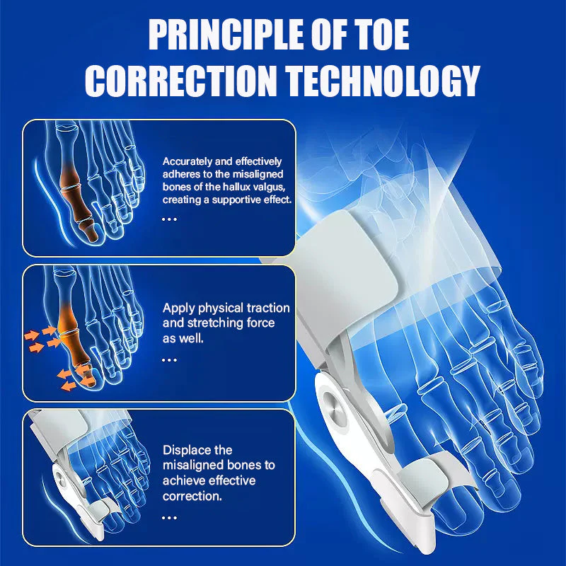 3D Bunion Splint Corrector Toe Trainer