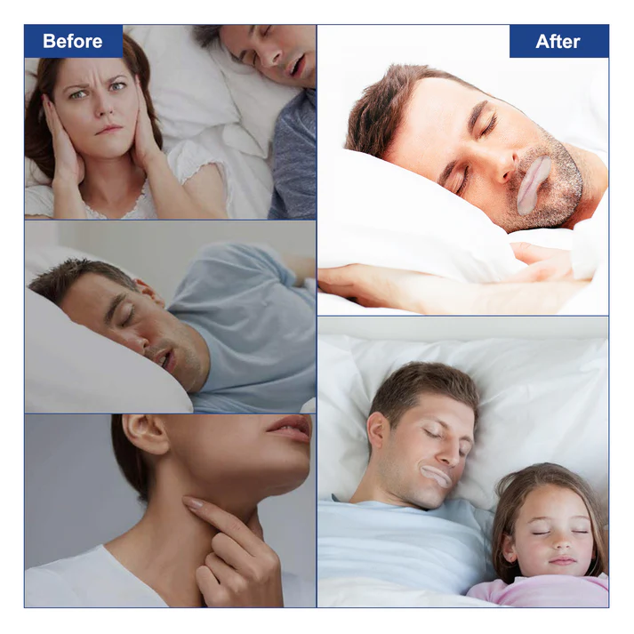 90 Pcs Mouth Tape Sleep Strip for Anti-snoring Mouth Breathing Tape To Improve Sleep Mouth Stickers for Snoring Lip Patch