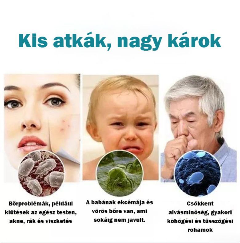 [Copy]50% kedvezménnyel🔥Házi nagyfrekvenciás atkaeltávolító eszköz