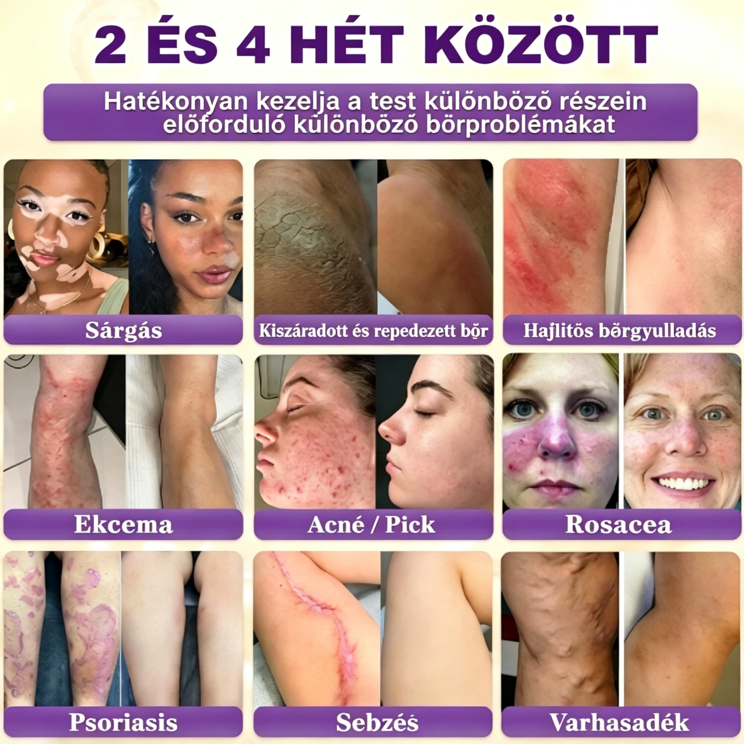 [Copy]NMN + Resveratrol MD által kifejlesztett sejtszintű NAD+ fokozó ultratiszta NMN-nel és resveratrolral, kutatásokkal alátámasztott dózisokban.