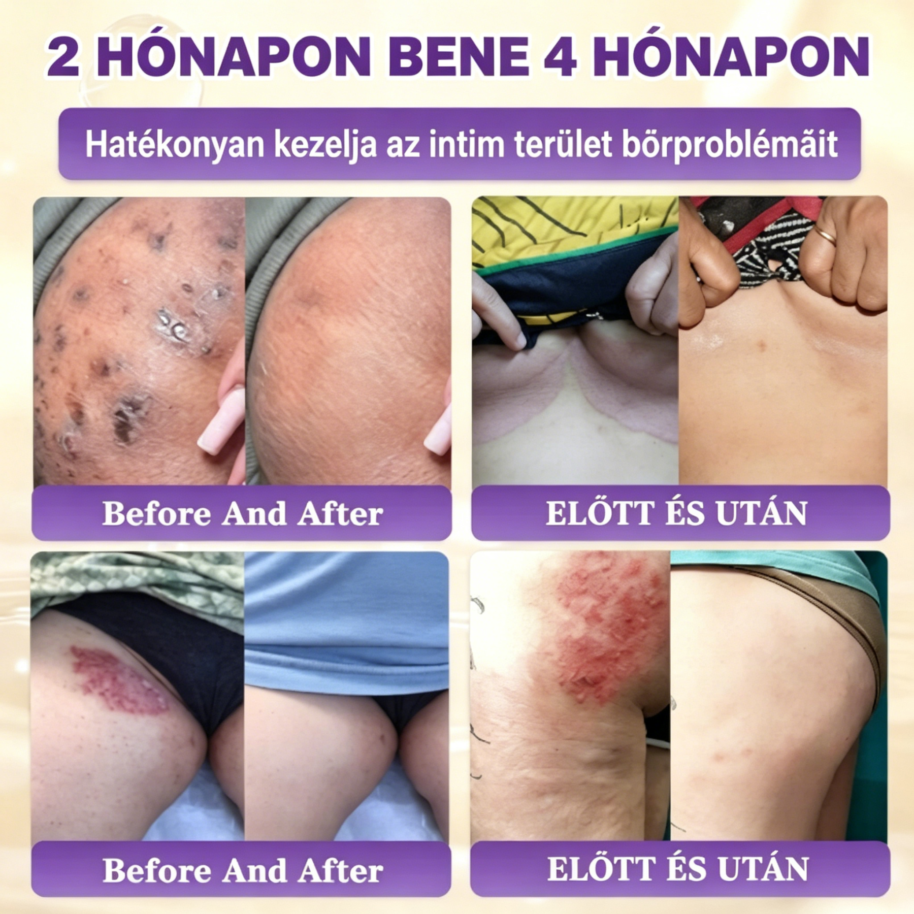 [Copy]NMN + Resveratrol MD által kifejlesztett sejtszintű NAD+ fokozó ultratiszta NMN-nel és resveratrolral, kutatásokkal alátámasztott dózisokban.
