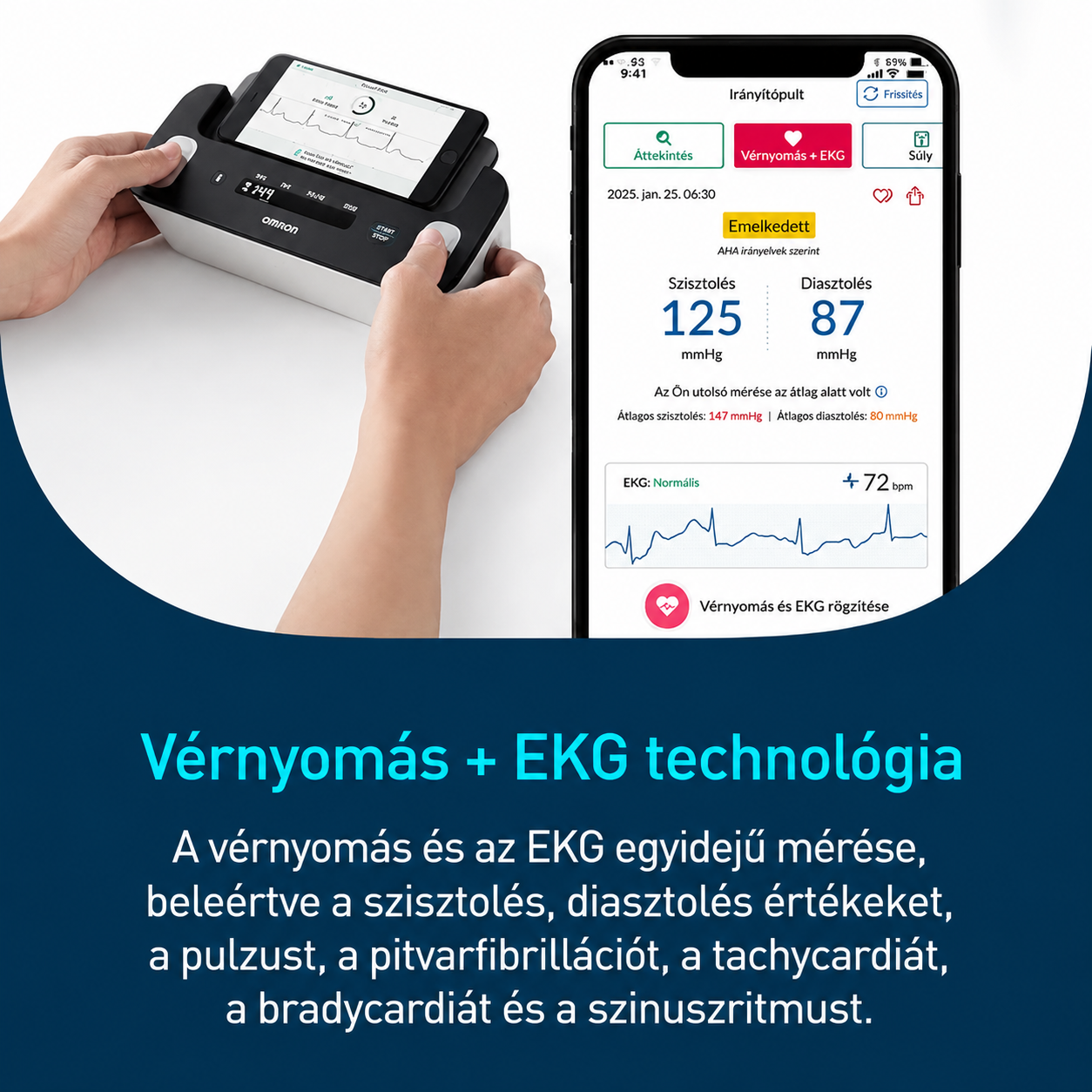 OMRON okos vércukor- és egészségmonitor otthonra: Minden fontos adat kéznél, egyszerű használat és teljes nyugalom a mindennapokban