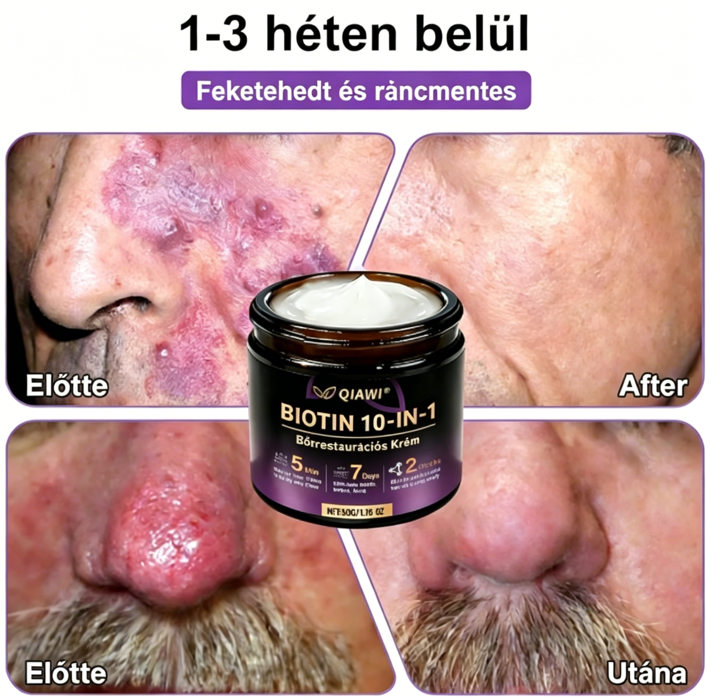 [Copy]NMN + Resveratrol MD által kifejlesztett sejtszintű NAD+ fokozó ultratiszta NMN-nel és resveratrolral, kutatásokkal alátámasztott dózisokban.
