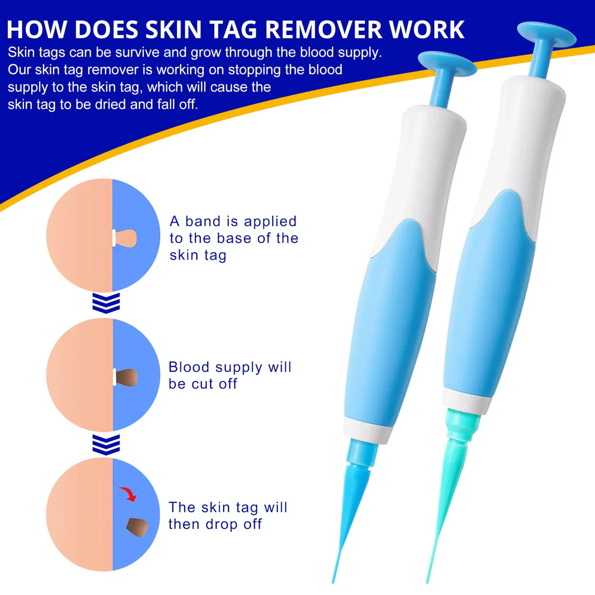 Auto Skin Tag Removal Professional Kit