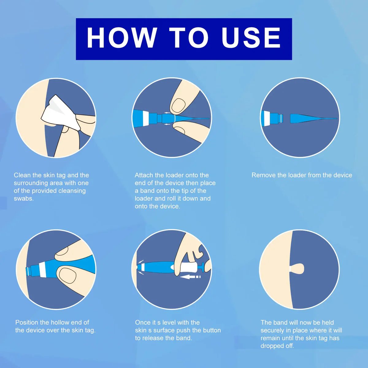 Auto Skin Tag Removal Professional Kit