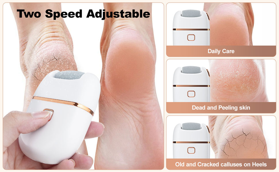 callus remover