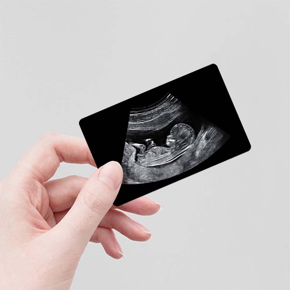Custom Photo Engraved Ultrasound Wallet Card New Dad Pregnancy Gift - soufeeluk