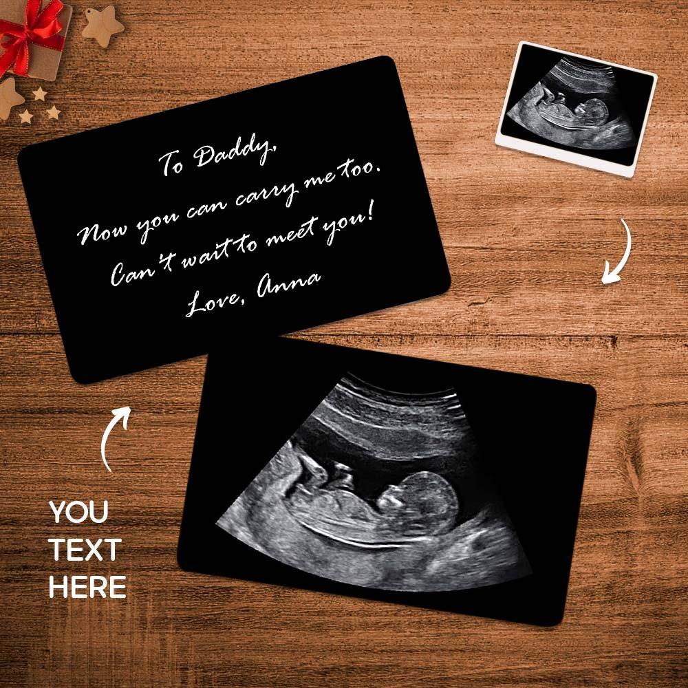 Tarjeta De Billetera Con Ultrasonido Grabada Con Foto Personalizada, Regalo De Embarazo Para Nuevo Papá - soufeeles