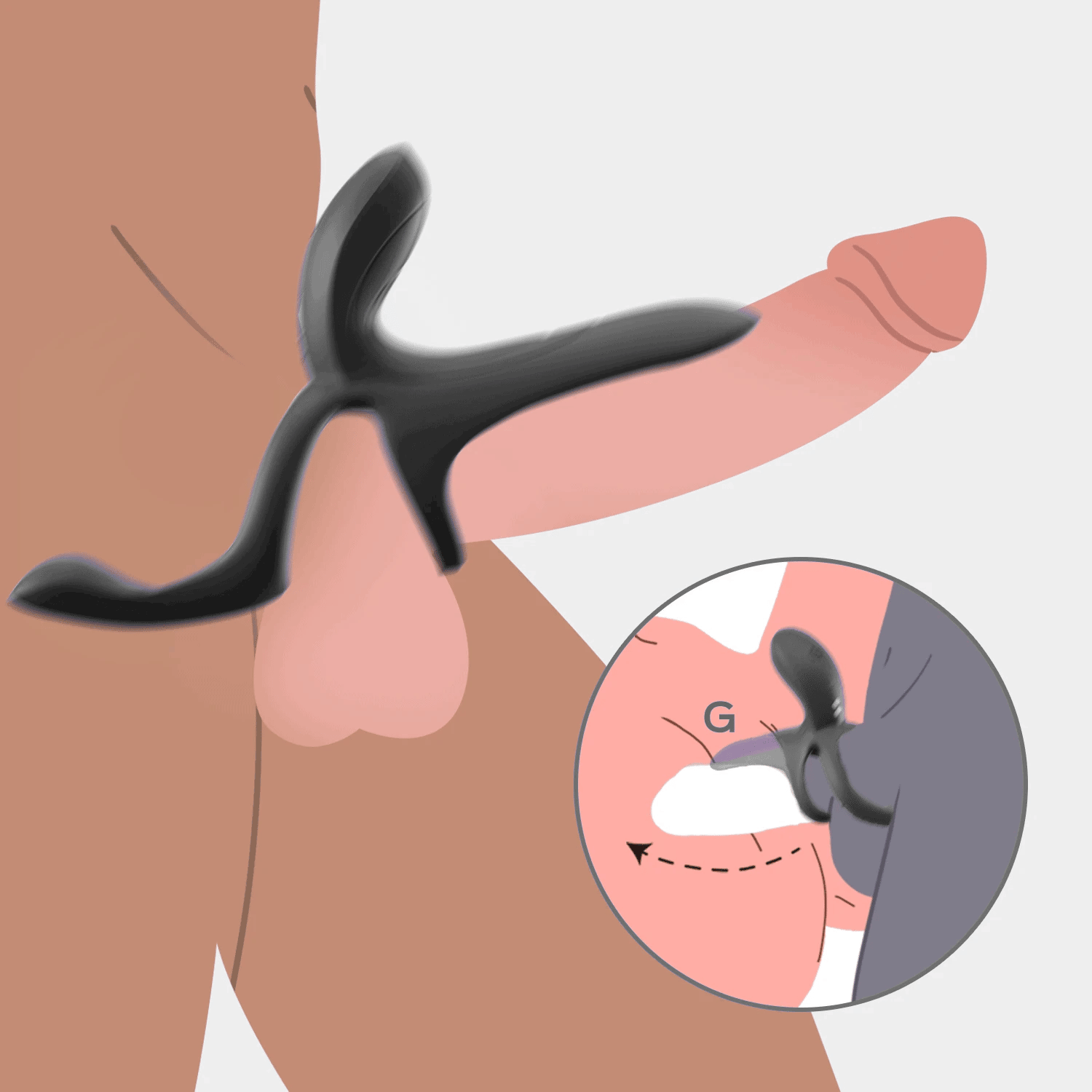 Male Wearable Sperm Locking Ring