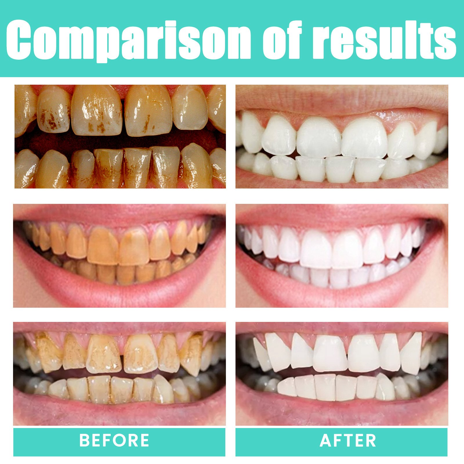 🔥LAST DAY 50% OFF⏰Cocomint Pulling Oil with 7 Essential Oils & Vitamins D, E & K2