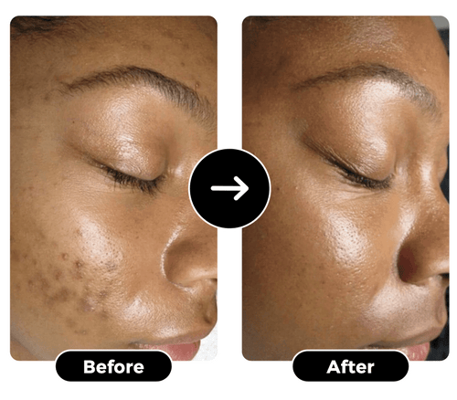 j9o8.png__PID:5936a603-e72c-4a0b-b727-3221a307c2bc